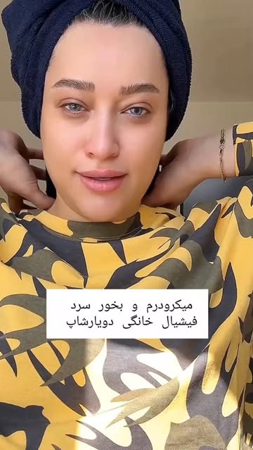 میکروپلاس مونتاژ کره